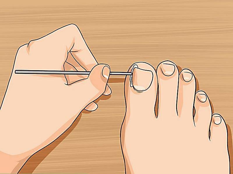 Как подстричь ногти на руках – народные приметы и правила ухода