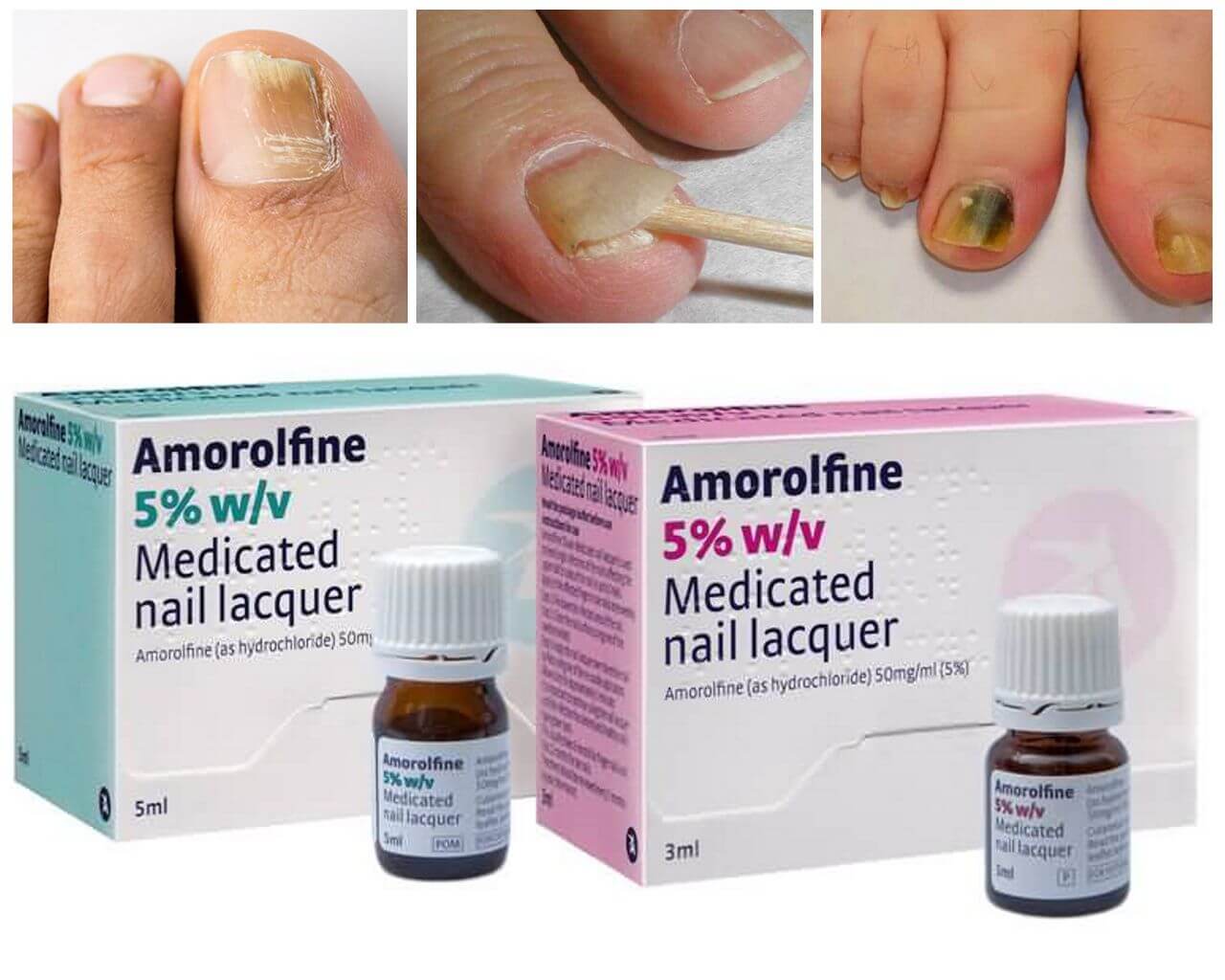 Недорогие и эффективные лаки от грибка ногтей: обзор лечебных препаратов, отзывы