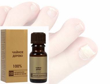 Масло чайного дерева от грибка ногтей: применение эфирного масла для лечения грибка на пальцах рук и ног, отзывы