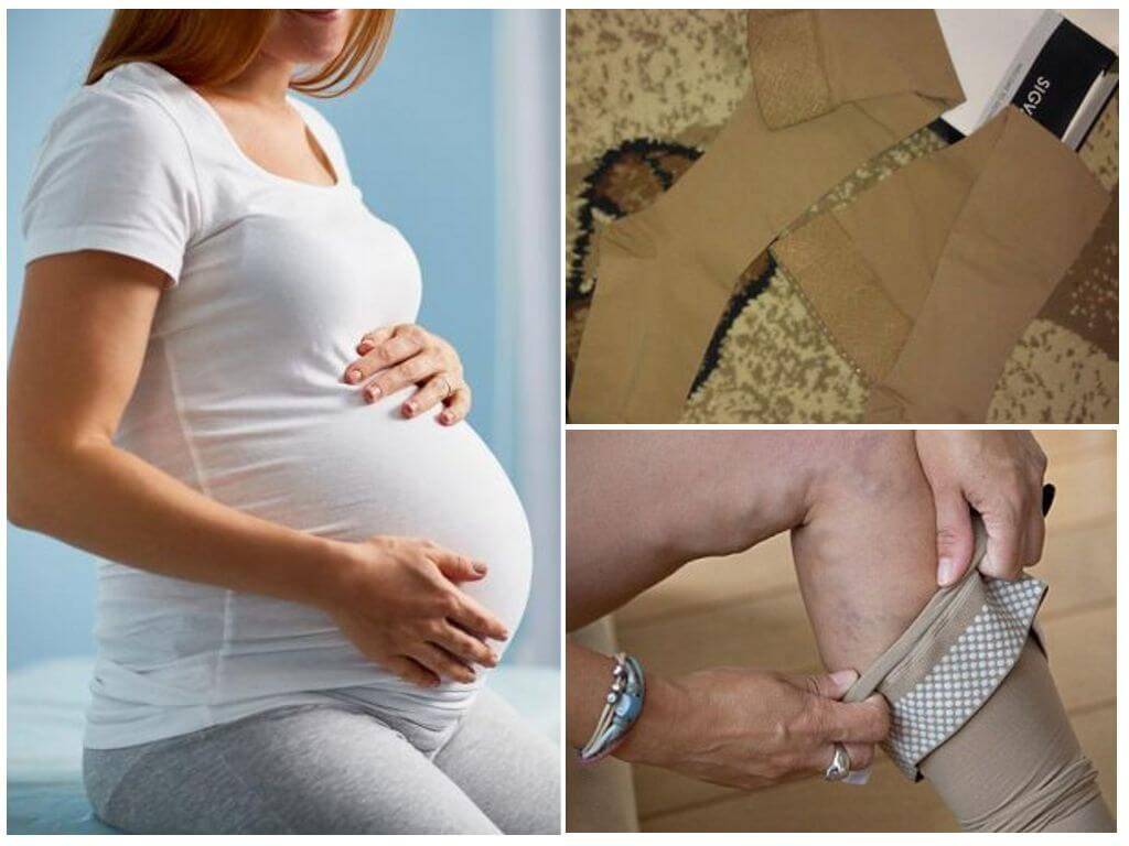 Почему беременным нужно. Компрессионные чулки для беременных. Компрессионные чулки у беременной. Чулки для беременных для родов. Компрессионная терапия у беременных.