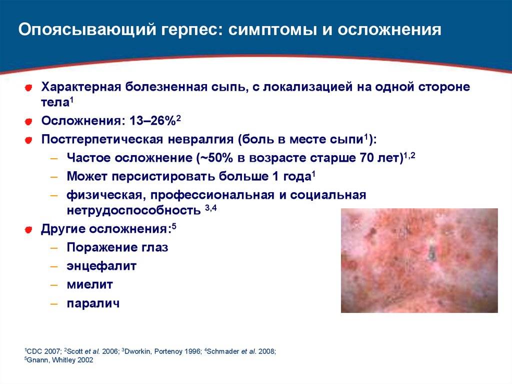 Последствия опоясывающего лишая: осложнения у пожилых на теле, чем опасен для окружающих, как лечить | pro-herpes.ru